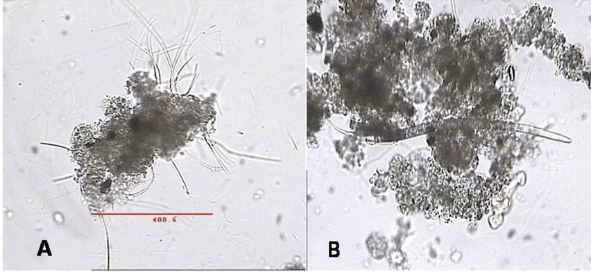 Imagem microscópica de partículas de biofloco: (A) floculação com algas filamentosas e bactérias; (B) flóculos de biofloco com nematoides.